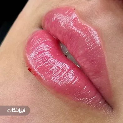 کلینیک زیبایی نگاره