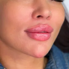 کلینیک زیبایی نگاره