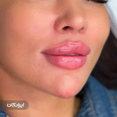 کلینیک زیبایی نگاره