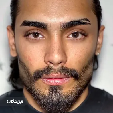 کلینیک زیبایی آدورا