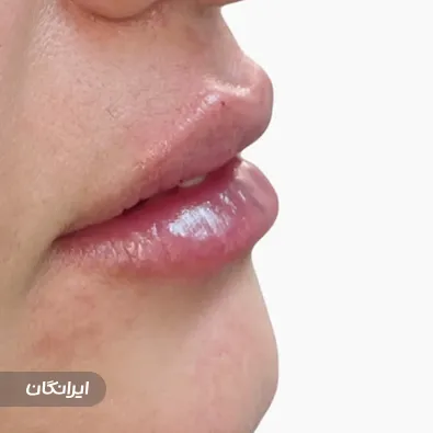 کلینیک زیبایی دکتر الناز شمس