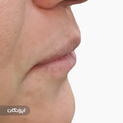 کلینیک زیبایی دکتر الناز شمس