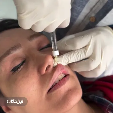 کلینیک زیبایی درموهیل