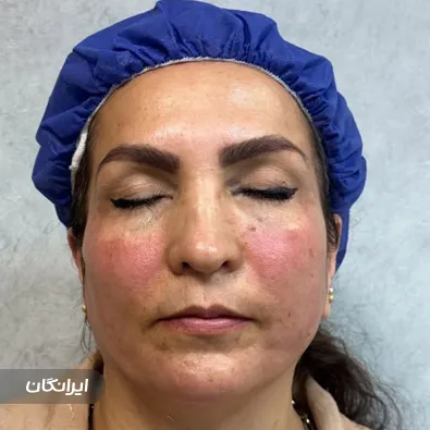 کلینیک زیبایی دکتر شعله زکی خانی