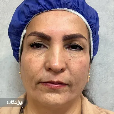 کلینیک زیبایی دکتر شعله زکی خانی