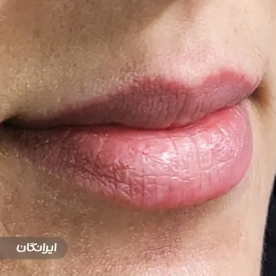 کلینیک زیبایی دکتر سروش طایفی