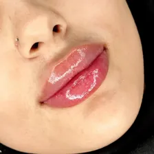 کلینیک زیبایی دکتر مرضیه اسماعیلی اول