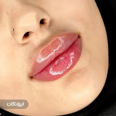 کلینیک زیبایی دکتر مرضیه اسماعیلی اول