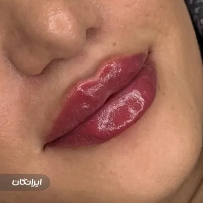 کلینیک زیبایی دکتر مرضیه اسماعیلی اول