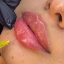 کلینیک زیبایی دکتر رضا رهام