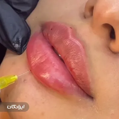 کلینیک زیبایی دکتر رضا رهام