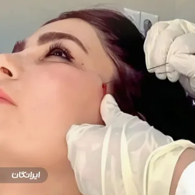 کلینیک زیبایی اس تی