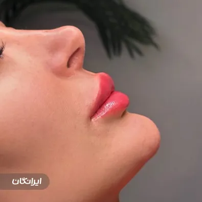 کلینیک زیبایی لیسا