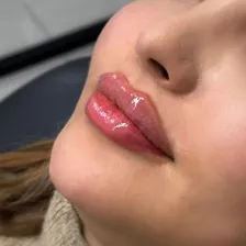 کلینیک زیبایی لیسا