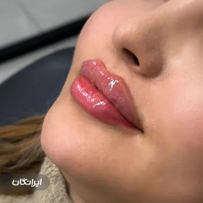 کلینیک زیبایی لیسا