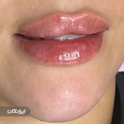 کلینیک زیبایی دکتر مریم ایزدیان