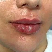 کلینیک زیبایی ماهورا