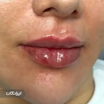 کلینیک زیبایی ماهورا