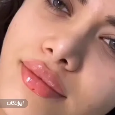 کلینیک زیبایی آرمیس