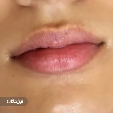 کلینیک زیبایی آرمیس