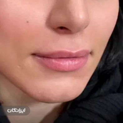 کلینیک زیبایی دکتر مریم زارع رفیع