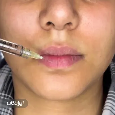 کلینیک زیبایی دکتر مریم زارع رفیع