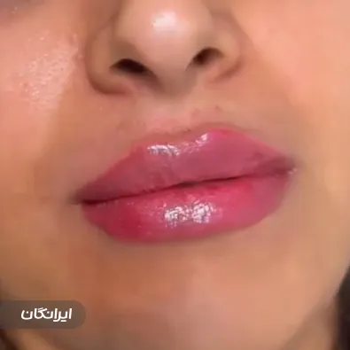 کلینیک زیبایی دکتر انسیه حقیقی پور