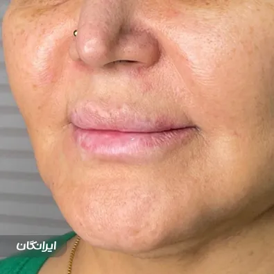 کلینیک زیبایی دکتر معصومه میرزالو