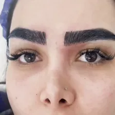 کلینیک کاشت مو اصیلا