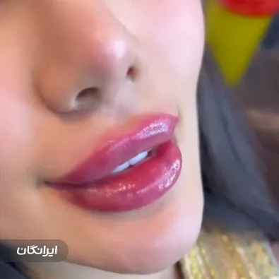 کلینیک زیبایی وینور