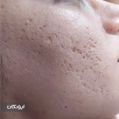 کلینیک زیبایی پوپک