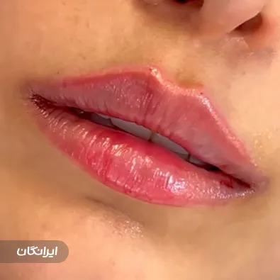 کلینیک زیبایی مهوین