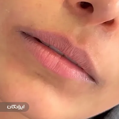 کلینیک زیبایی مهوین