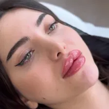 کلینیک زیبایی مهوین