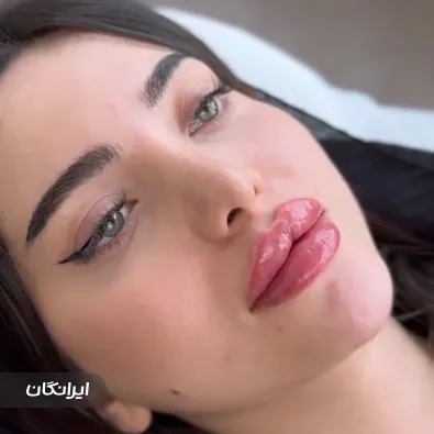 کلینیک زیبایی مهوین