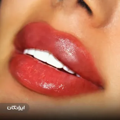 کلینیک جراحی ویانا