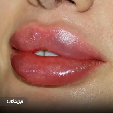 کلینیک جراحی ویانا