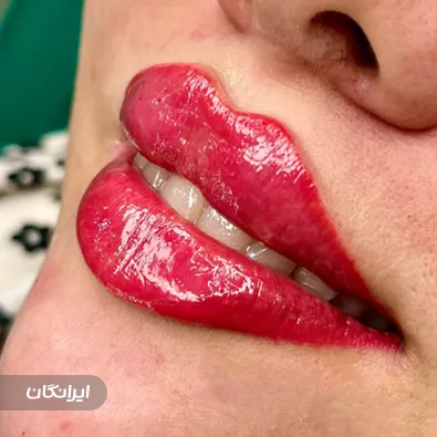 کلینیک زیبایی مینا