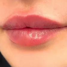 کلینیک زیبایی پاترا