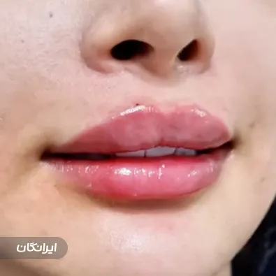 کلینیک زیبایی رایلی