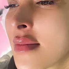 کلینیک زیبایی بلا