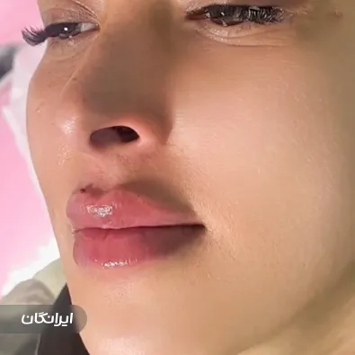 کلینیک زیبایی بلا