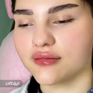 کلینیک زیبایی بلا