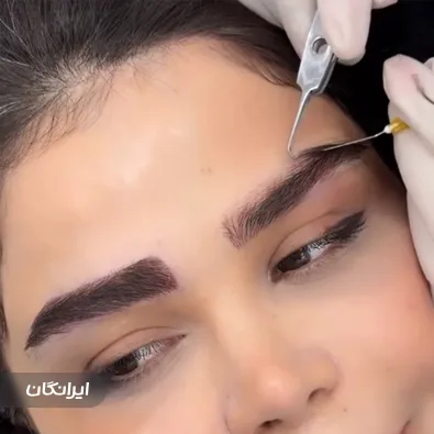 کلینیک کاشت مو کارن