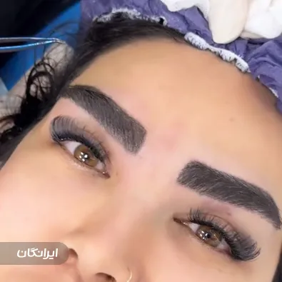 کلینیک کاشت مو کارن