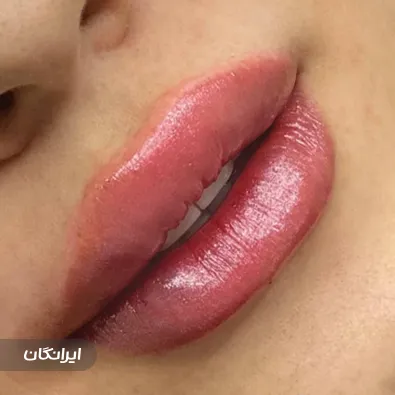 کلینیک زیبایی آئورا