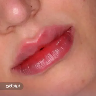 کلینیک زیبایی آئورا