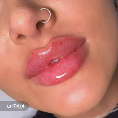 کلینیک زیبایی مانا