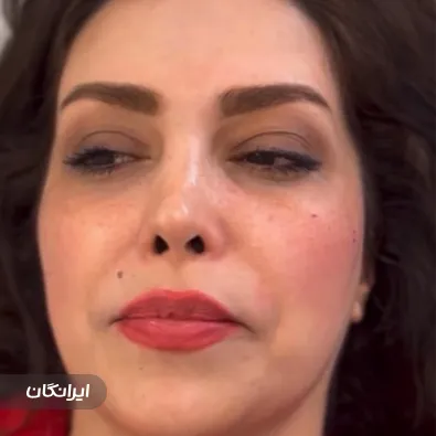 کلینیک زیبایی دکتر زهرا مرآتی