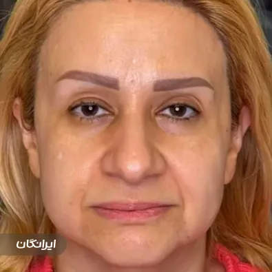 کلینیک زیبایی دکتر کیمیا وطن دوست